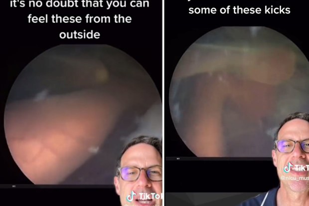 The twins' feet were clear in the vision shared on TikTok. 