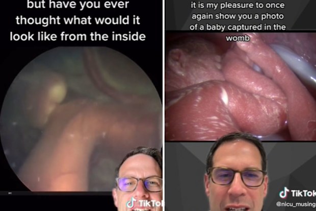 Dr Michael Narvey shares vision from a fetoscope. 