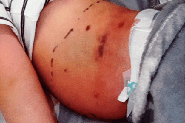 A circle was drawn around the marks to see if they spread