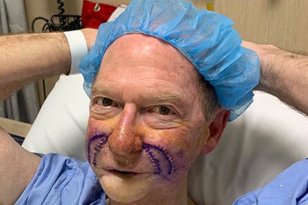 John Blackman, surgery, photo, hospital