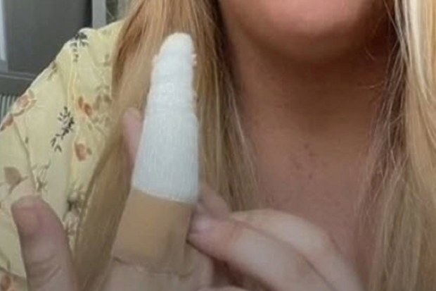 Woman finger cyst