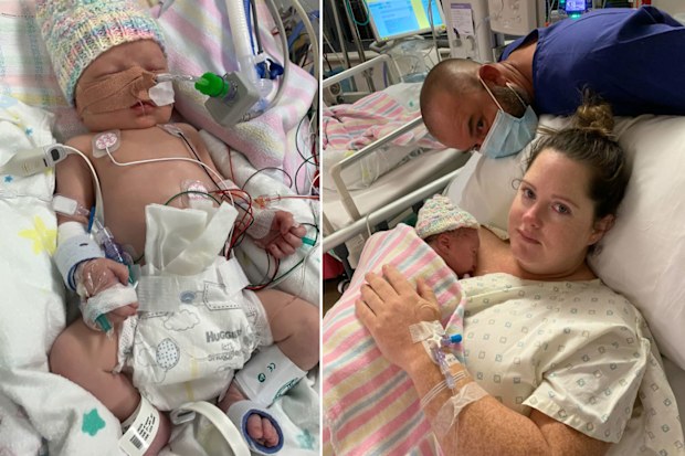 Baby Riley was born with several complex heart conditions.