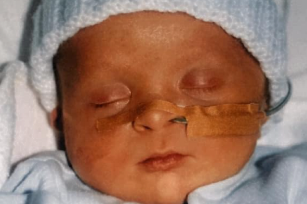 Darcy Fisher born Down's syndrome carer's week