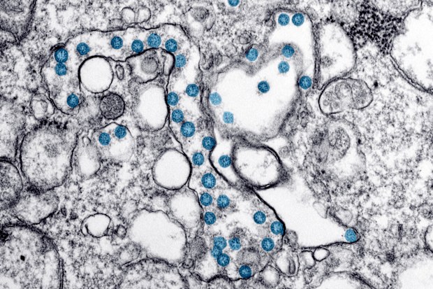 This electron microscope image made available by the US Centers for Disease Control and Prevention shows the spherical particles of the new coronavirus, colorised blue, from the first US case of COVID-19