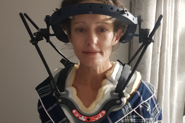 Mother hypermobility neck brace