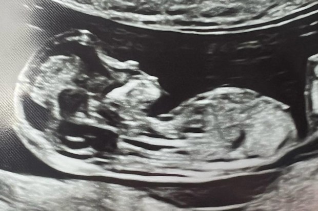 Irena and Locky Gilbert learned they were expecting their rainbow baby Ava after two miscarriages.