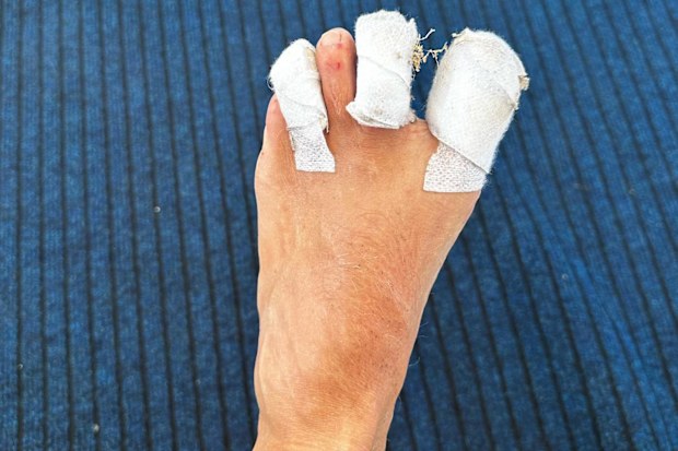 Colin Jost foot