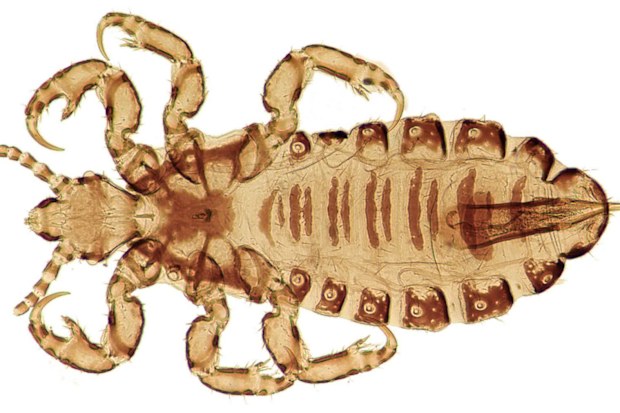 Human history is recorded in the the DNA of head lice.
