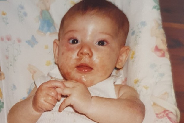 Rhiannon Grant spent her life living with severe allergies and is now an allergy researcher.