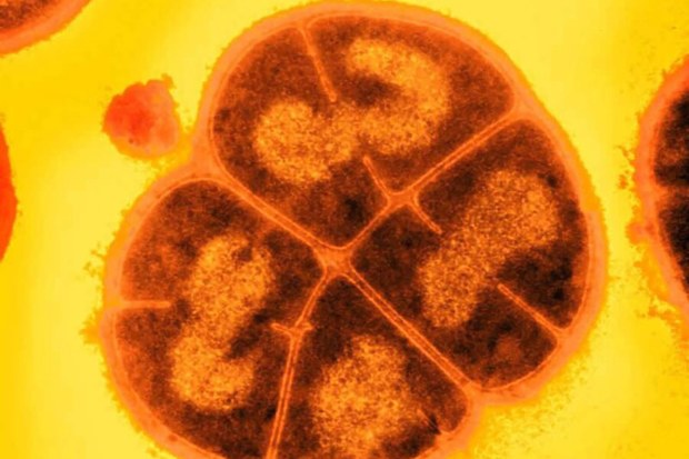 Deinococcus radiodurans, also called "Conan the Bacterium" by scientists, is seen under a microscope.