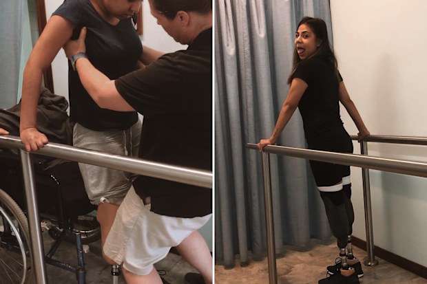 Juttima Chinnasri re-learning how to walk with prosthetics.