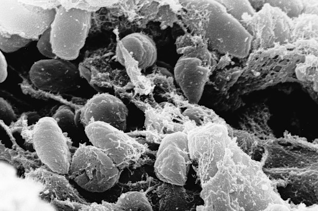 Although plague is inextricably linked to the Black Death pandemic of the 14th century that killed about 50 million people in Europe, it remains a relatively common disease.