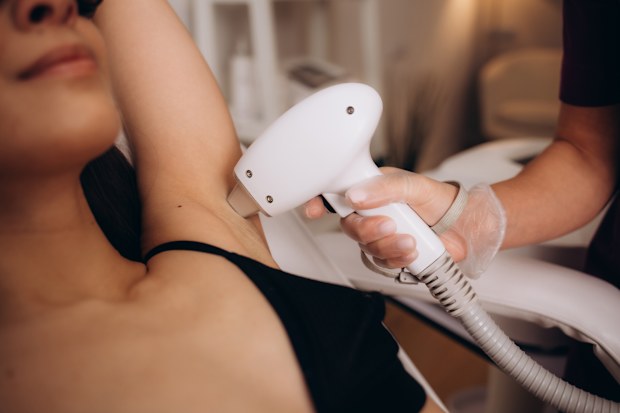 Laser hair removal