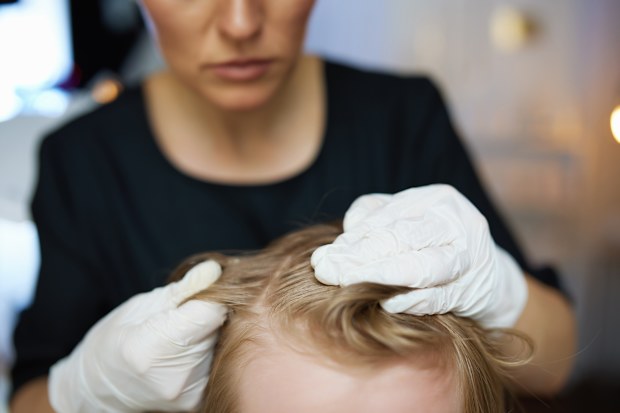 Head lice and nits in children: How to break the cycle of nits | 'Help ...