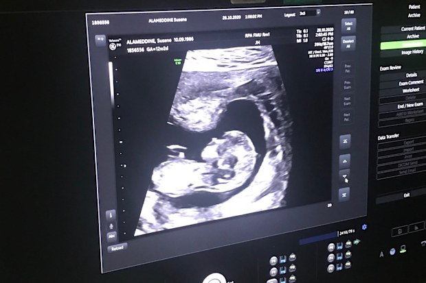 Susane and Daniel IVF ultrasound photo
