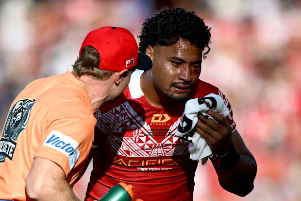 AUCKLAND, NUEVA ZELANDA - 2 DE NOVIEMBRE: Eliza Katoa de Tonga es atendida por un entrenador durante el partido del Campeonato Masculino del Pacífico entre los Kiwis de Nueva Zelanda y Tonga en Eden Park el 2 de noviembre de 2025 en Auckland, Nueva Zelanda. (Foto de Hannah Peters/Getty Images)