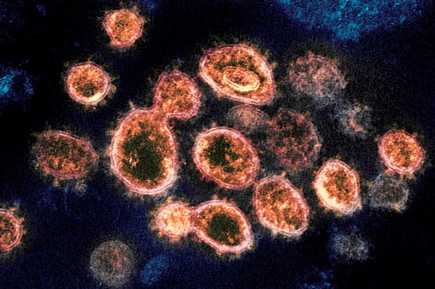 This electron microscope image shows SARS-CoV-2 virus particles which cause COVID-19.