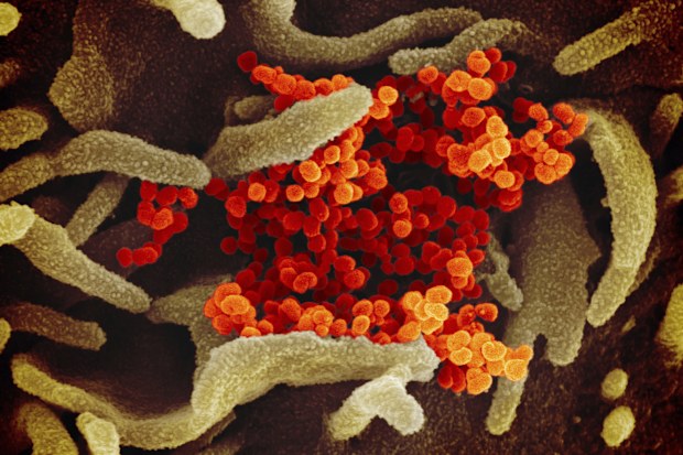 The Novel Coronavirus SARS-CoV-2, orange, emerging from the surface of cells, green, cultured in the lab. Also known as 2019-nCoV, the virus causes COVID-19. The sample was isolated from a patient in the United States.