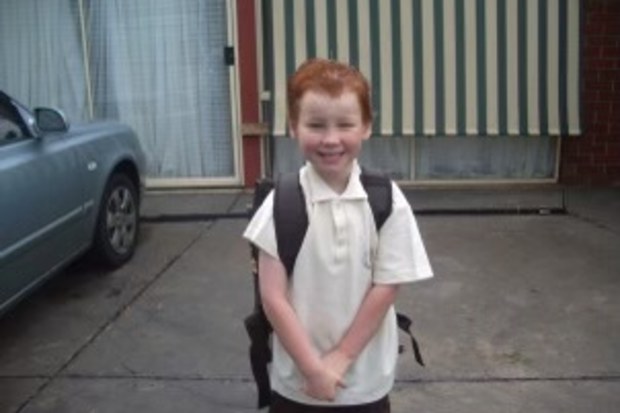 Jacobs syndrome story