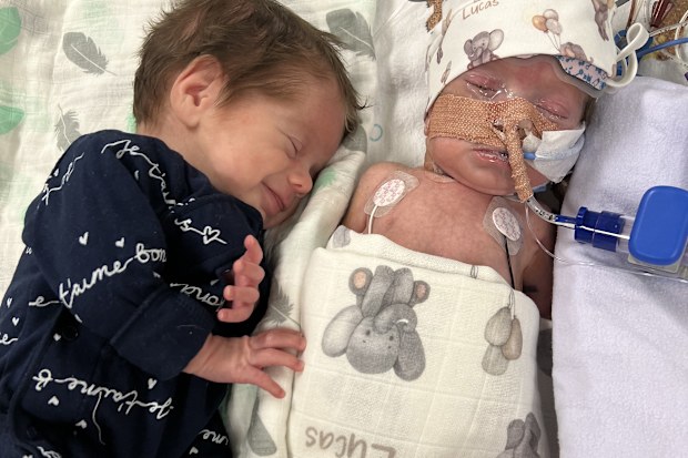 Lucas and Bailey were born 13 weeks prematurely 