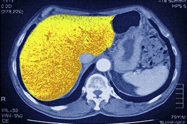 Health officials say they have detected more cases of a mysterious liver disease.