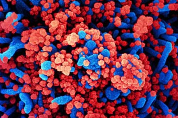 Microscopic image of COVID-19 disease (Getty)