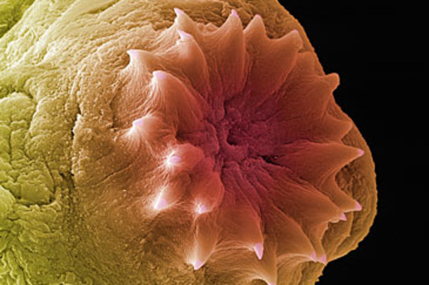 Tapeworm (Getty)