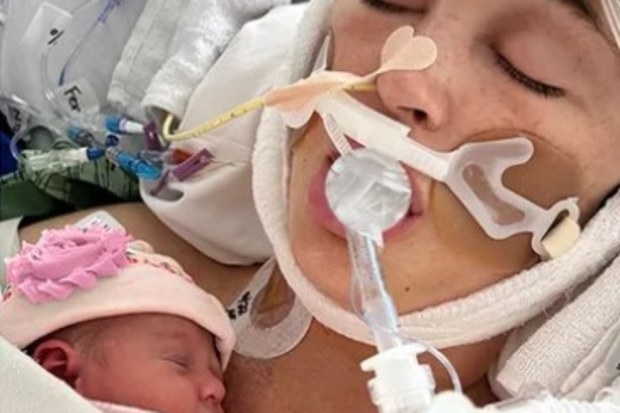 Jackie Miller James gave birth to her daughter while in a coma.