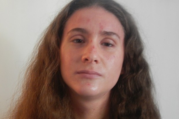 Rhiannon Grant lived with with life-threatening allergies her whole life.