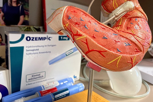 A view of a plastic model of a stomach and some Ozempic packaging