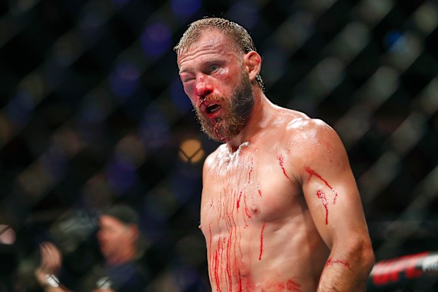 Feguson said he would be down for a rematch. AP Photo/Kamil Krzaczynski