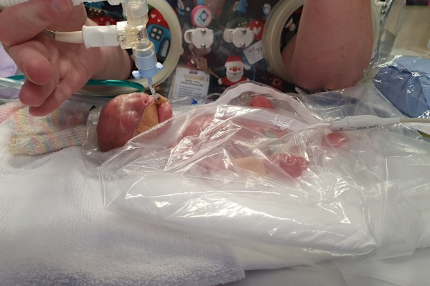 premature birth miracle baby Mater Mothers' Hospital in South Brisbane