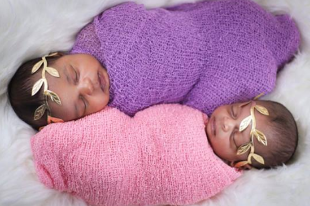 Baby girl accidentally dropped on her head by doctors