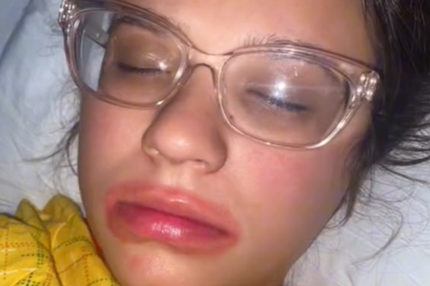 Mum reveals hilarious chapstick mishap after epidural.