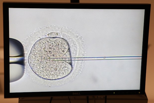 Geneas embryology lab showing the video screen where scientists are performing ICSI procedure where a needle is used to place a single sperm into an egg for fertilise it. 2nd November 2011 Photograph by Dallas Kilponen