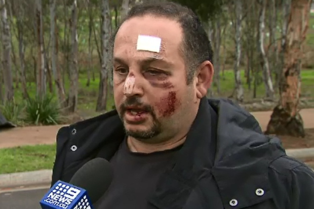 Charlie said it's the third time he's been attacked and will think twice about intervening next time.