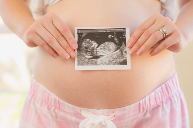 Pregnant woman holding ultrasound photo over belly