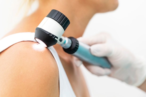 Skin cancer check