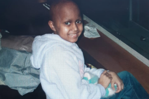 Lena Mishra as a child after losing her hair during brain cancer treatment.