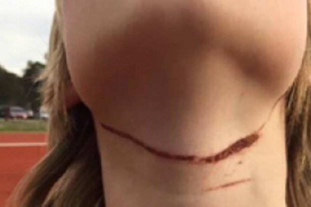 Devon Davies, 12, was knocked off his bike by a rope strung between trees. (Photo: Supplied)