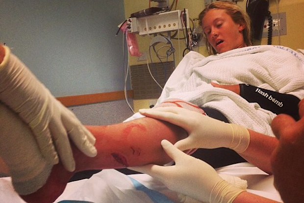 Kirra-Belle Olsson in hospital being treated for her injuries after the shark attack.