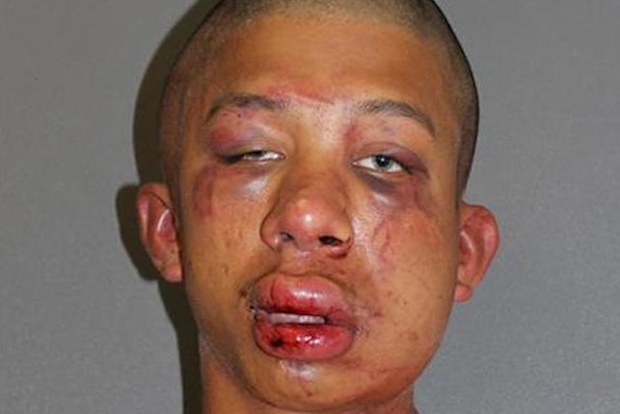 Raymond Frolander after being arrested. (Supplied)