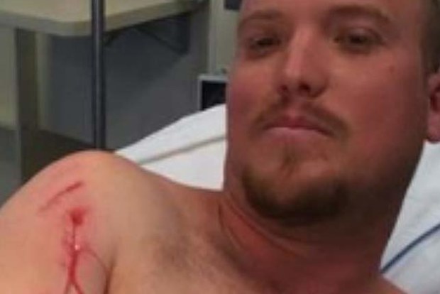 Chris Keeping. 29, fought his way out of the jaws of a 2.5m saltwater croc. (Supplied)