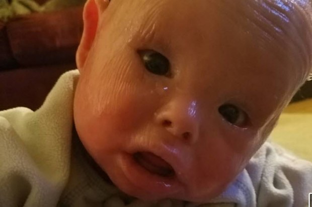 Jamison wasn't supposed to live. But this little fighter has already celebrated his first birthday. (Facebook)