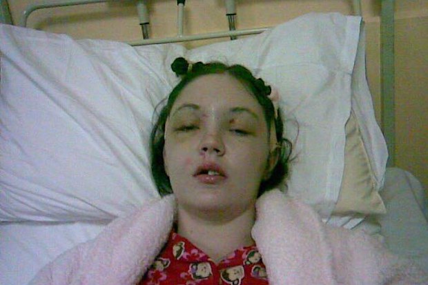Woman who lost forehead in car crash shares warning