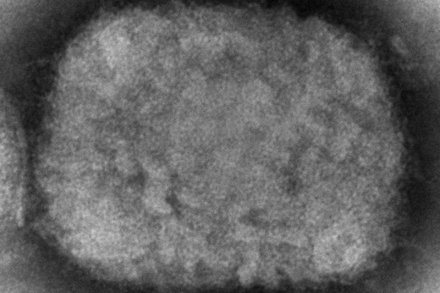This 2003 electron microscope image made available by the Centers for Disease Control and Prevention shows a monkeypox virion, obtained from a sample associated with the 2003 prairie dog outbreak. Monkeypox, a disease that rarely appears outside Africa, has been identified by European and American health authorities in recent days. (Cynthia S. Goldsmith, Russell Regner/CDC via AP)