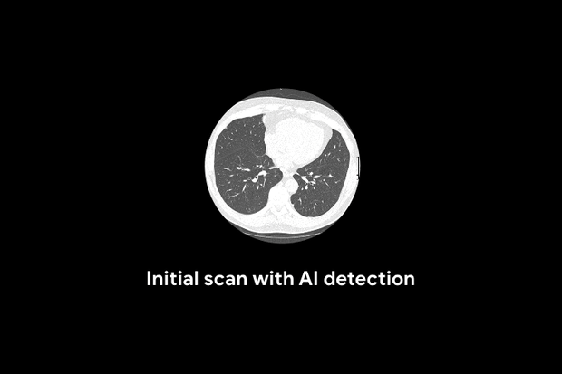 The AI has a better strike rate than trained doctors. 