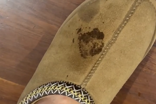 Ugg Boot stains 
