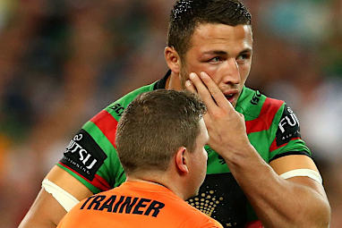 Burgess said at half time that his cheekbone was 'gone'.