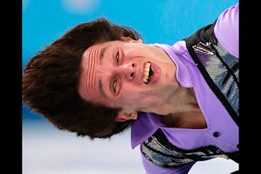 Israeli athlete Alexei Bychenko won't be winning any beauty contests with this photo. (AAP)